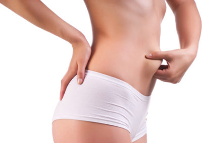 LIPOASPIRAÇÃO